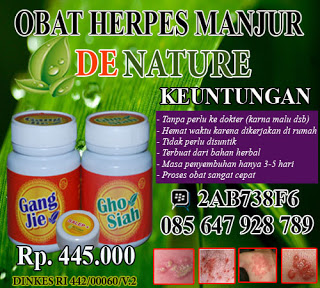 Illustration for article titled obat penyakit herves kelamin